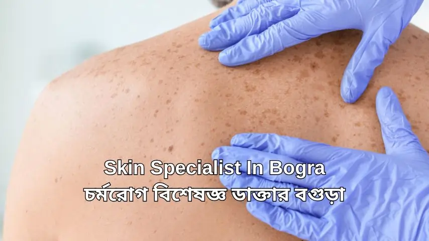 Best Dermatologist In Bogra | চর্মরোগ বিশেষজ্ঞ ডাক্তার বগুড়া